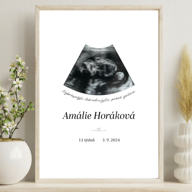 Plakát - Malý zázrak