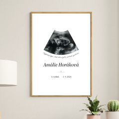 Plakát - Malý zázrak